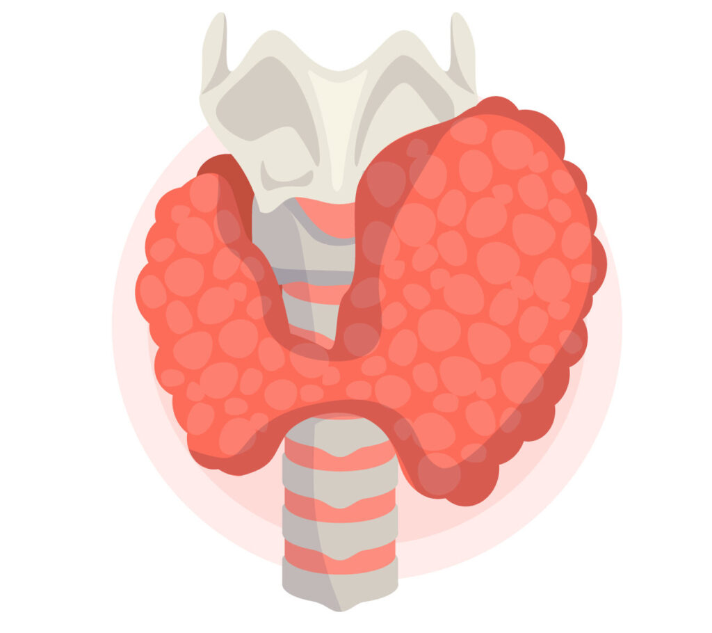 Thyroid Surgery