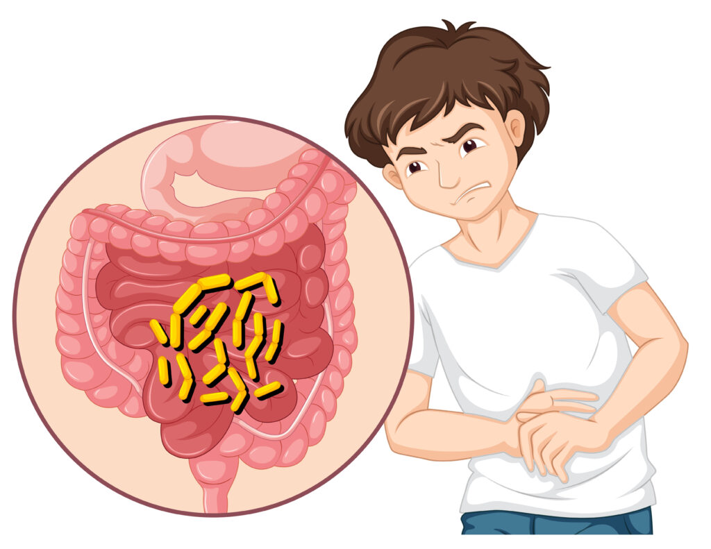 bowel abstructiion